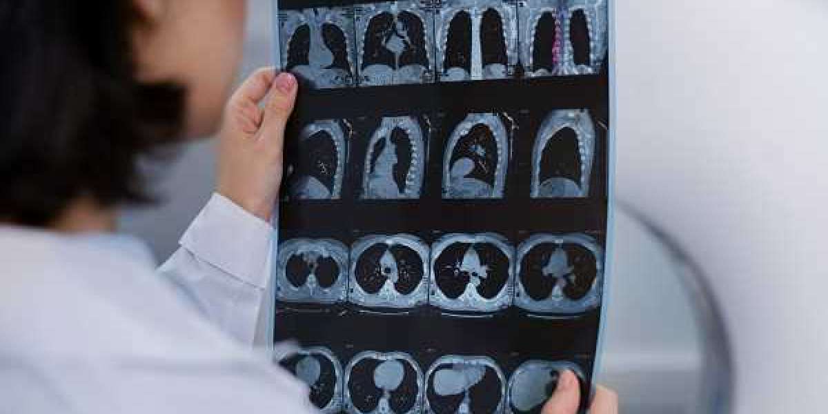 Medical Imaging Market Analysis and Expert Research Report Forecast to 2032