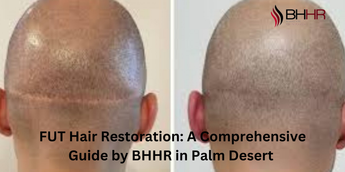 FUT Hair Restoration: A Comprehensive Guide by BHHR in Palm Desert 