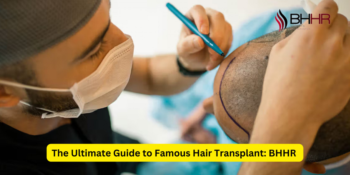 The Ultimate Guide to Famous Hair Transplant: BHHR 
