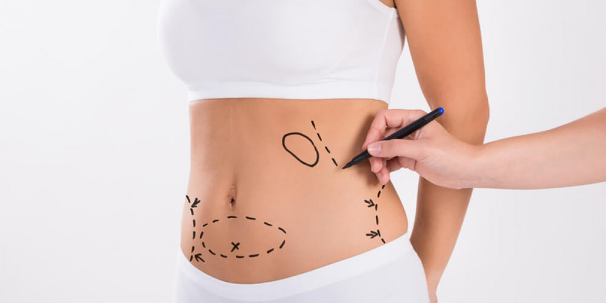 What Medications Should I Avoid Before Liposuction?