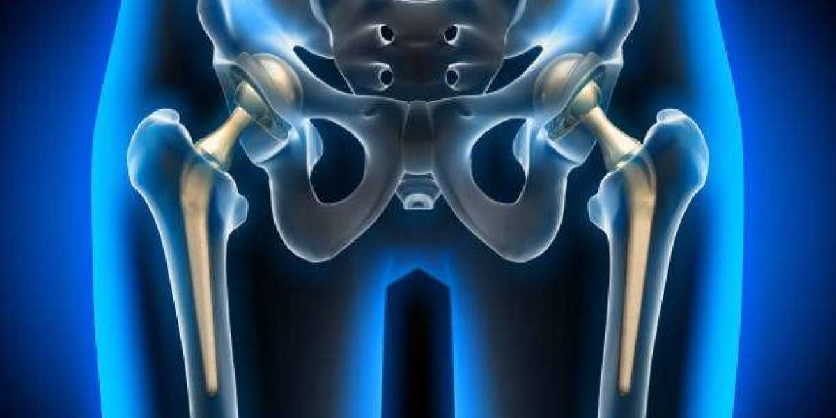 Expert Care Total Hip Replacement Surgery at Nagpur's Gadge Hospital