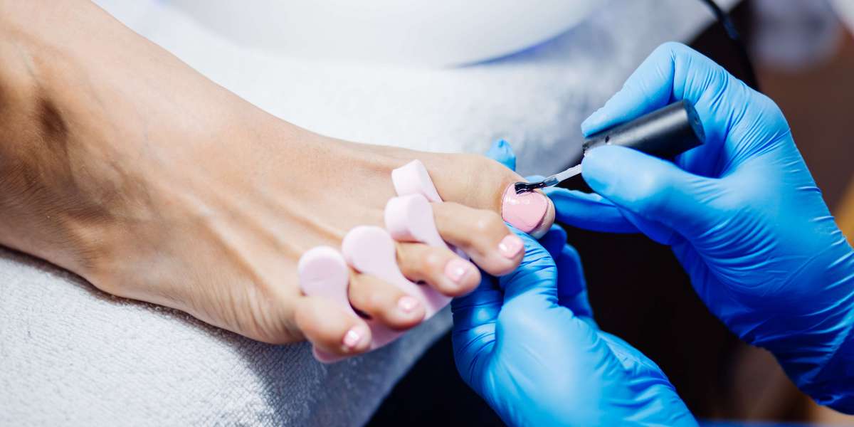 Ingrown Toenail Removal: Tips and Treatments for Quick Relief