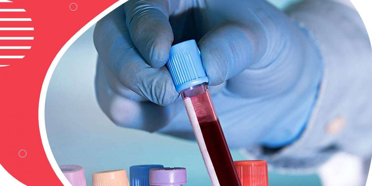 U.S. Liquid Biopsy Market 2024-2032's Most Important Market Trends