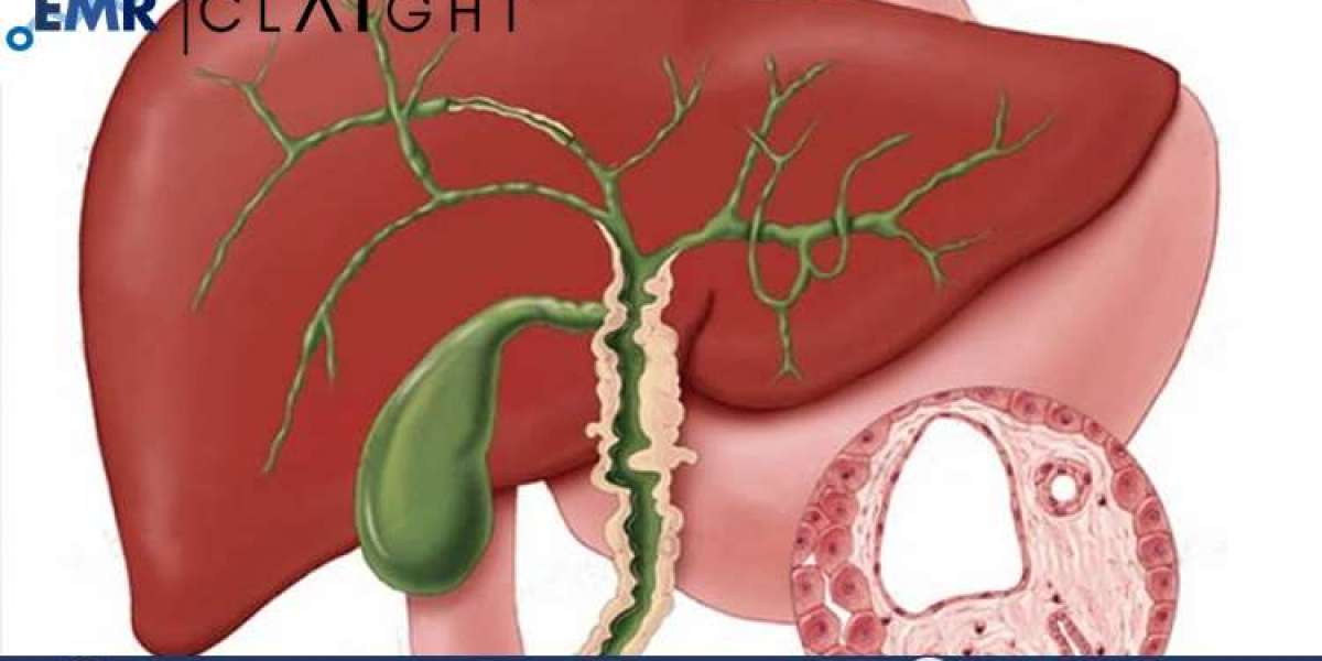 Primary Sclerosing Cholangitis Market: Comprehensive Analysis and Future Outlook