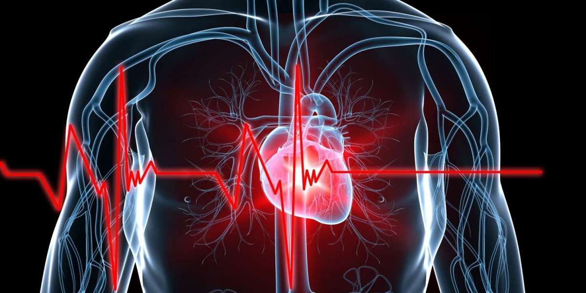 Cardiovascular Devices Market Growing Trends and Technology Forecast to 2034