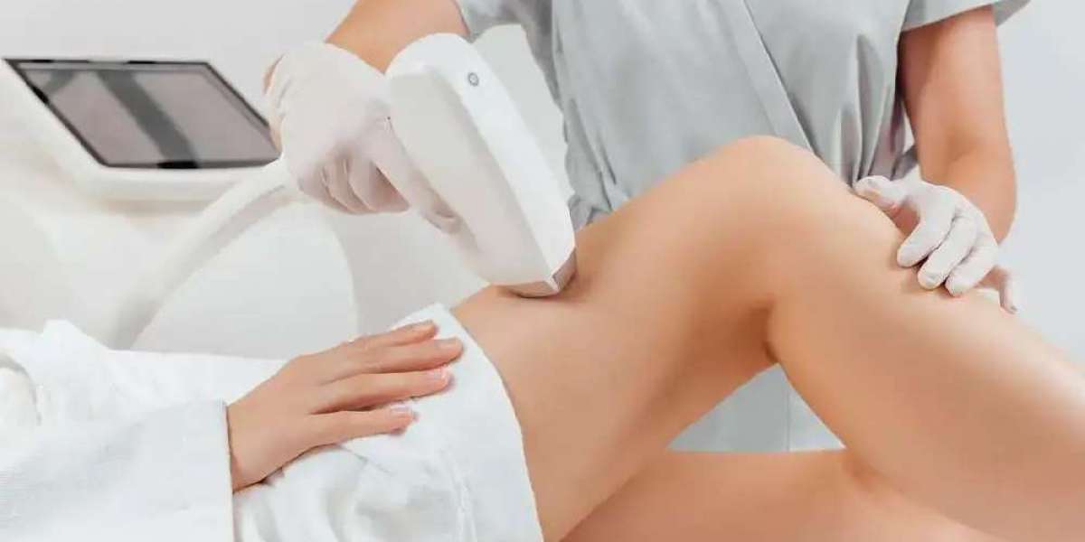 Laser Hair Removal Cost in Dallas, TX – Affordable Treatments at Sleek Laser Solutions