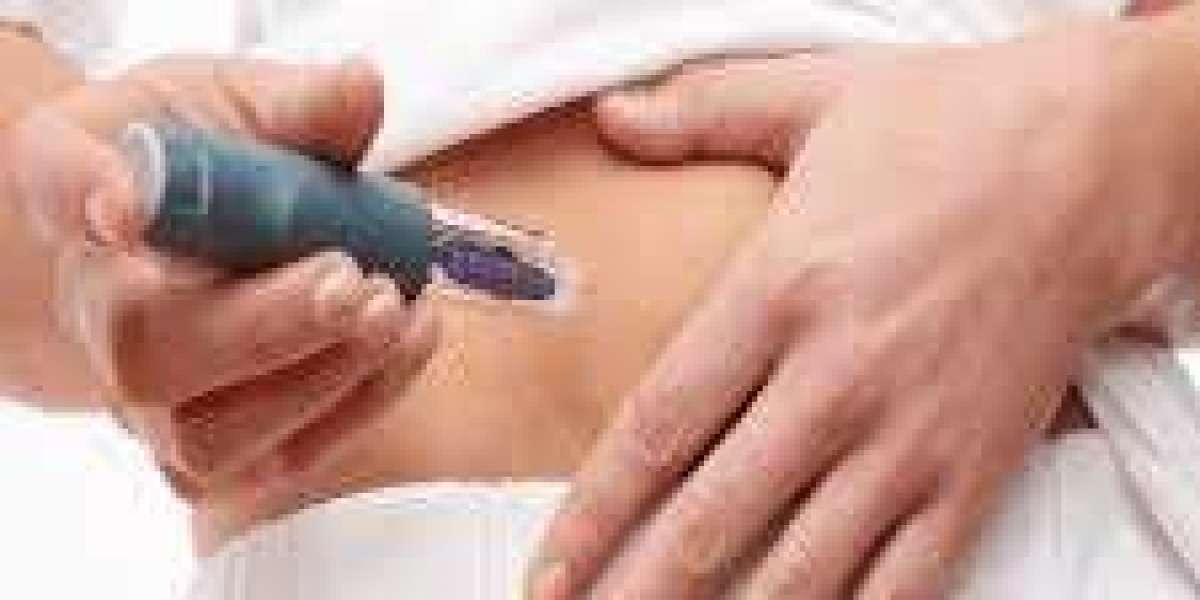 Why Choose Mounjaro Injection for Weight Loss in Dubai?