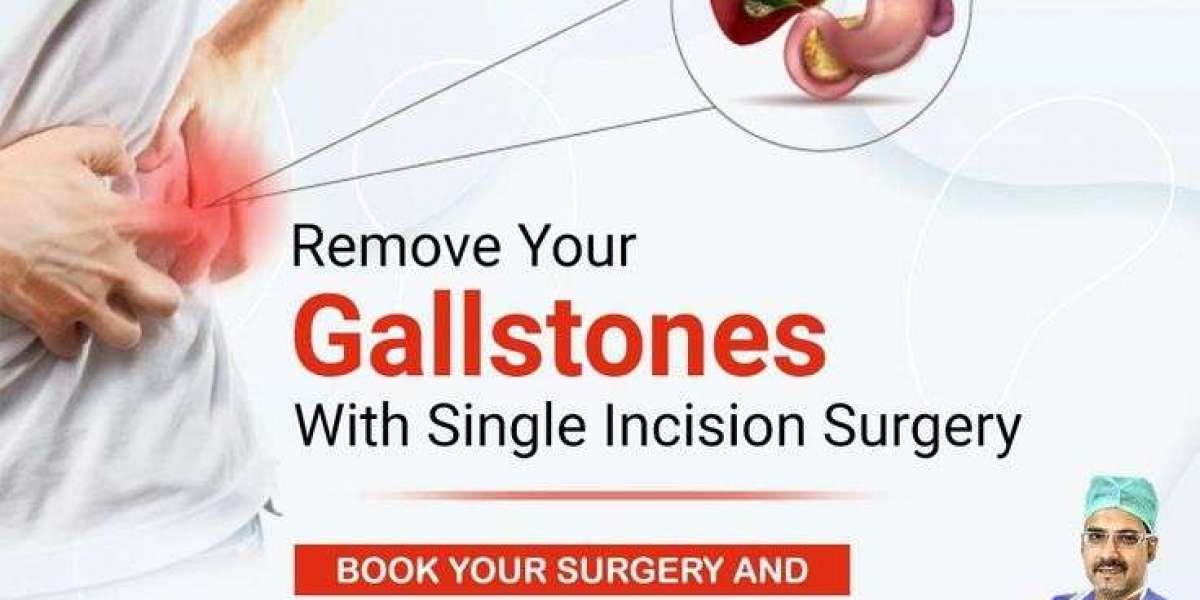 How to Remove Gallbladder Stone without Operation