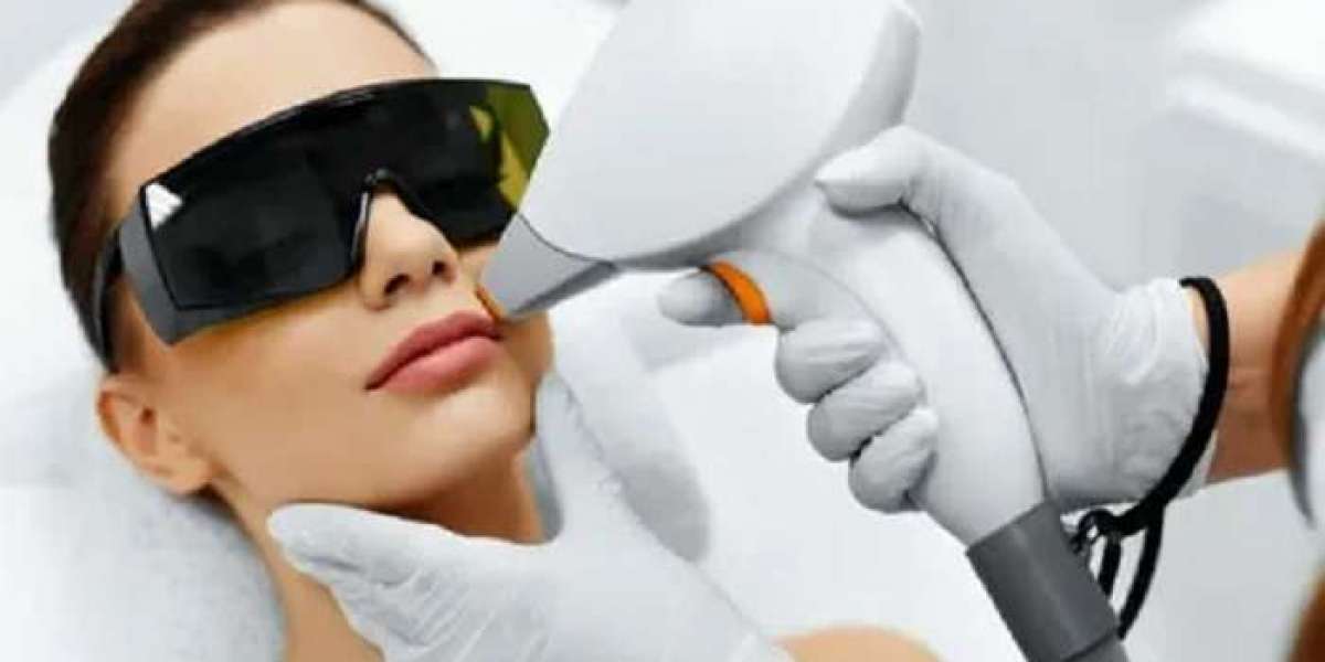 Laser Hair Removal in Riyadh: The Ultimate Guide to Smooth Skin