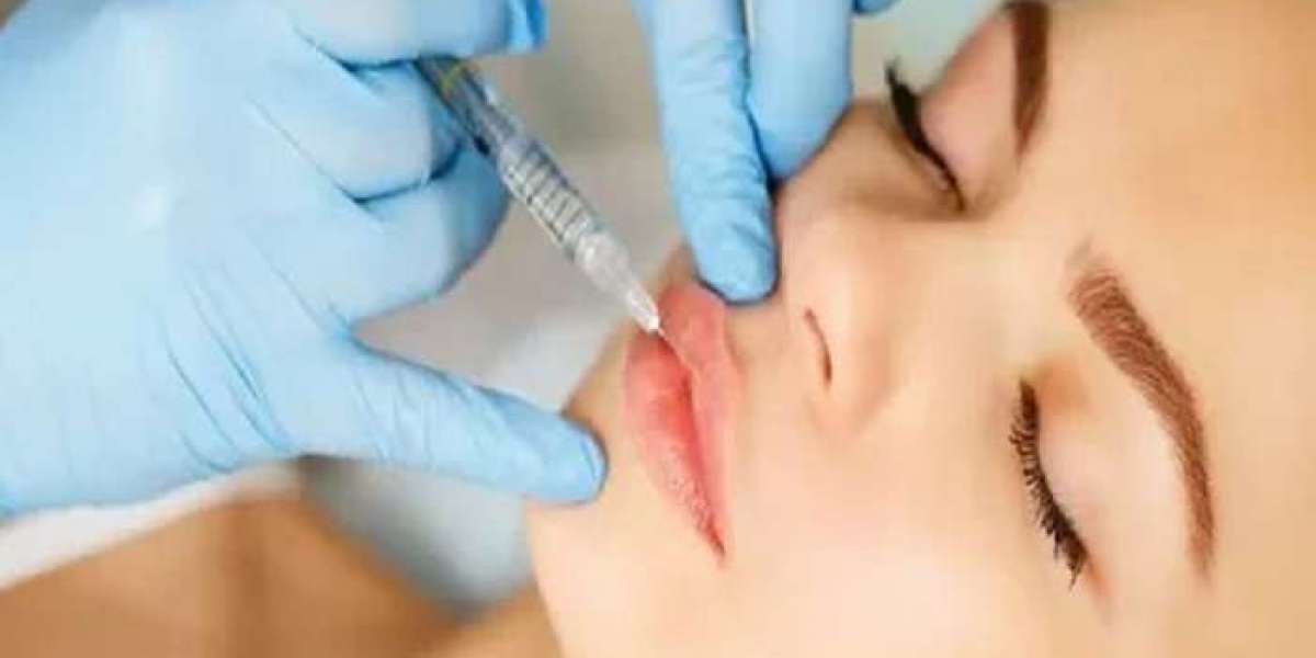 Lip Fillers Injection in Riyadh: A Comprehensive Guide