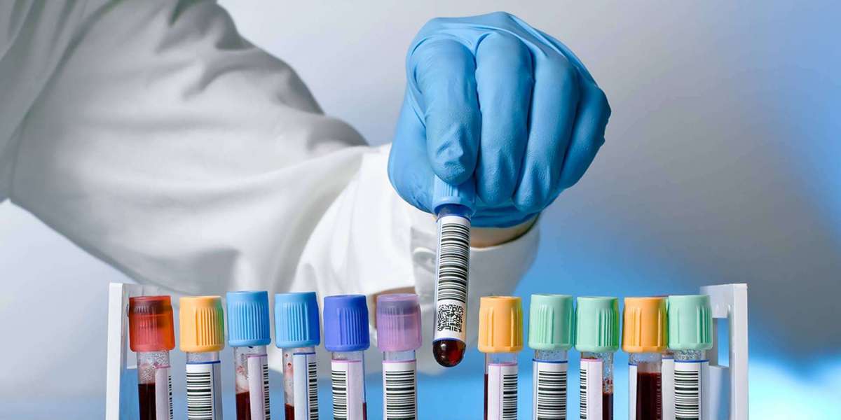 Urine Routine Test Cost in Hyderabad: Get Accurate Results at Trulife Diagnostic