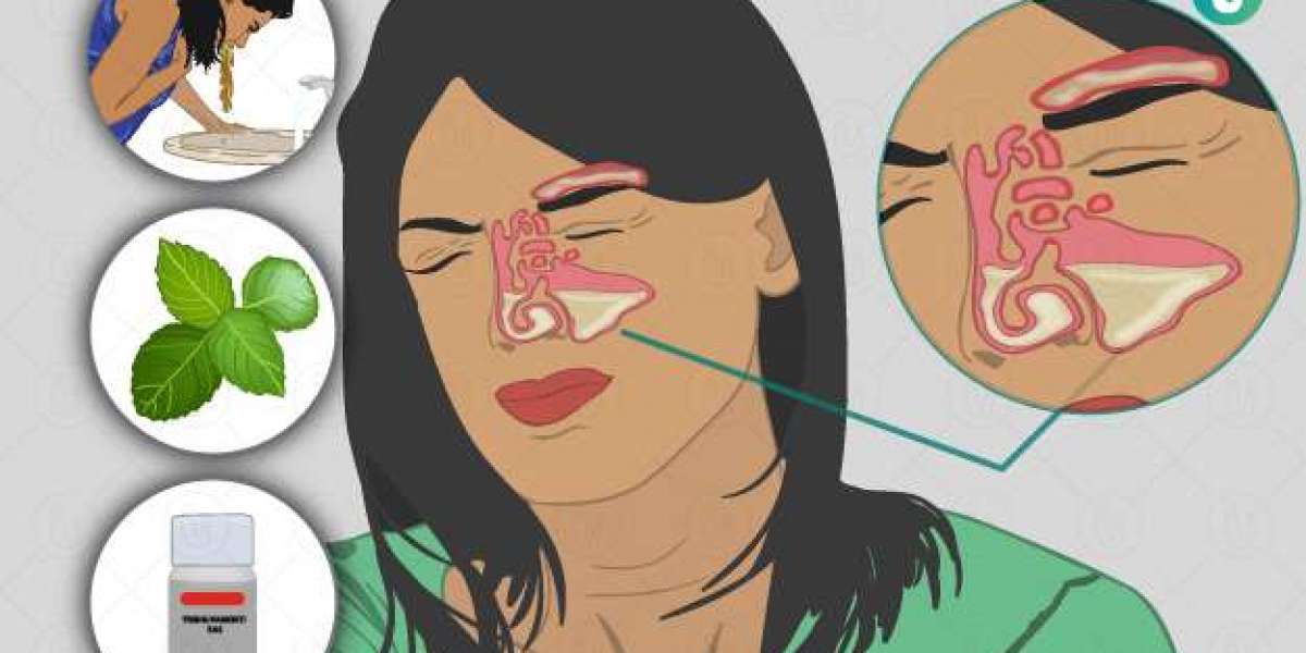 Sinusitis Drug Pipeline Analysis Report 2024