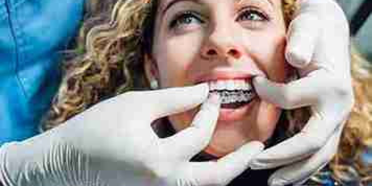 Achieve Ideal Teeth Alignment through Invisalign Technology