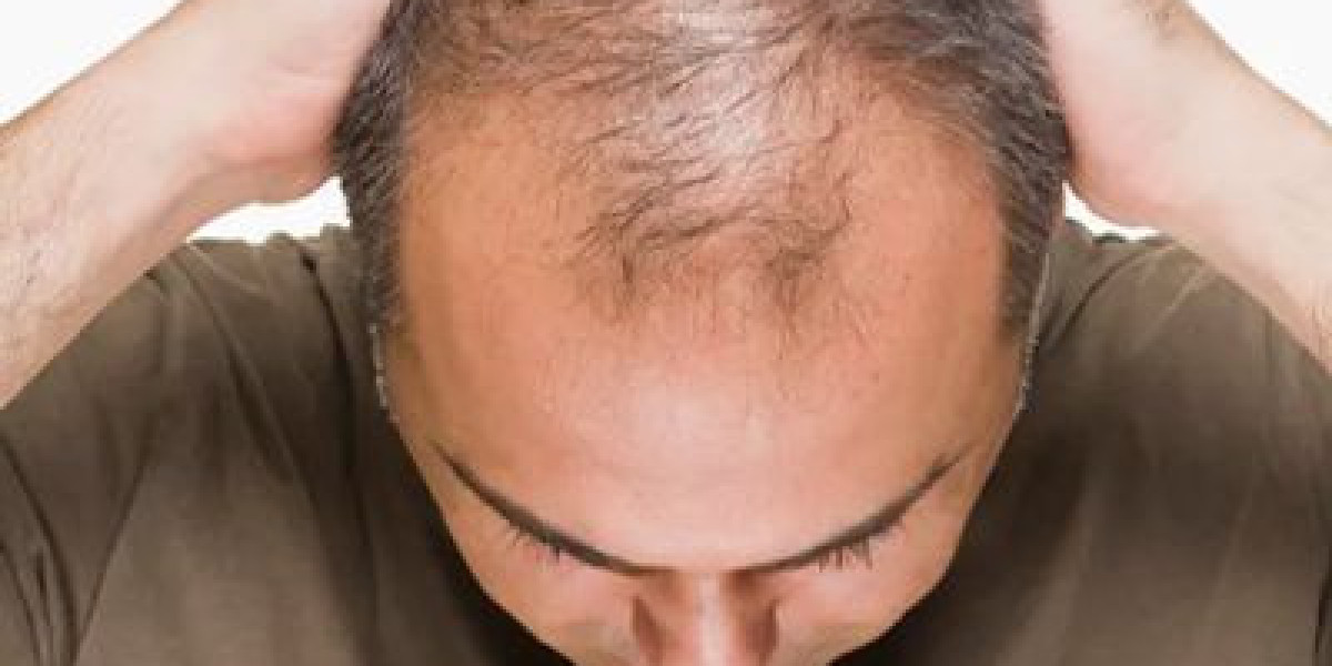 Exosomes Hair Therapy in Dubai: A Breakthrough Path to Reviving Hair Density