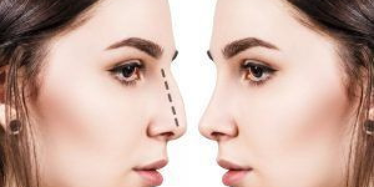 Can Teens Get Rhinoplasty in Dubai?