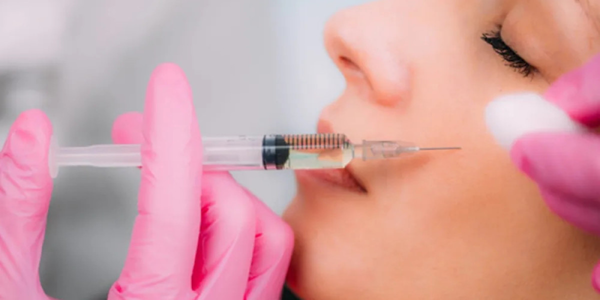 Cheek Fillers Injections Give Your Cheeks Smooth, Stunning Contours