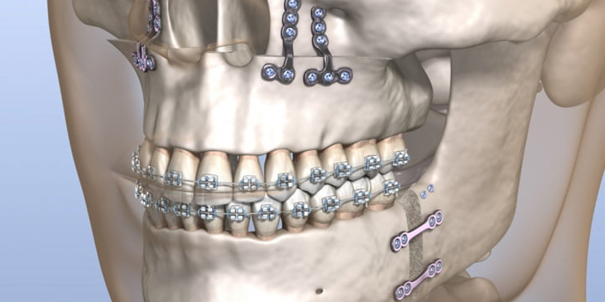 Pre-surgery tests and evaluations for jaw surgery in Islamabad