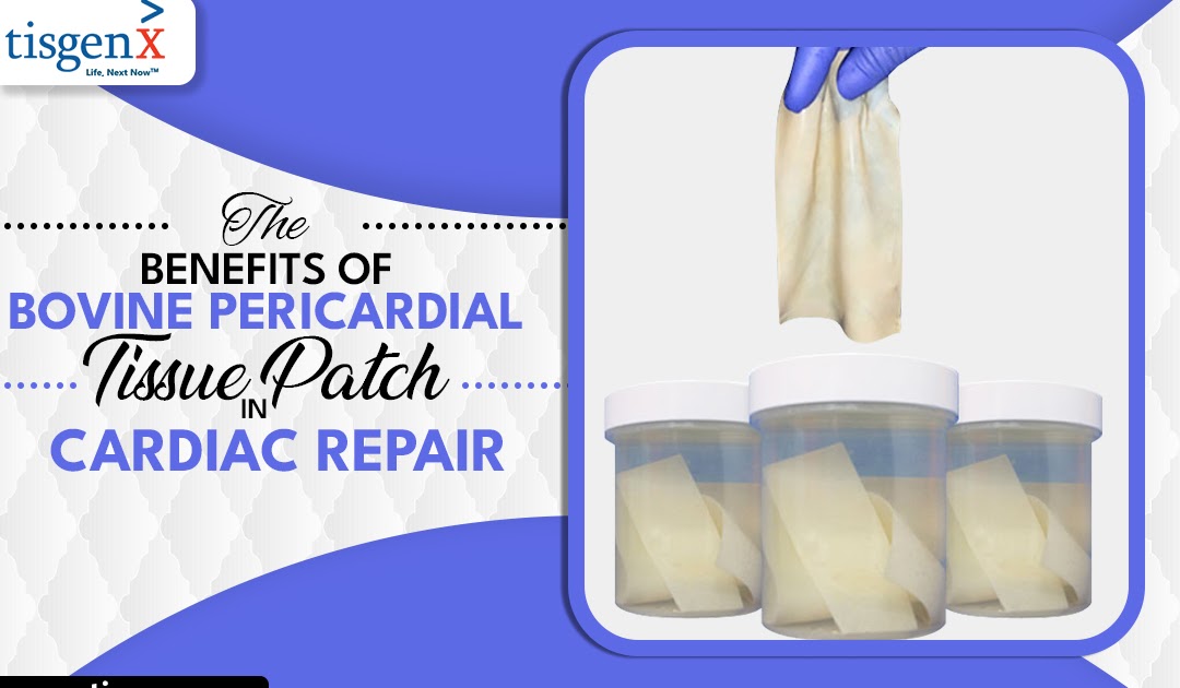 The Benefits Of Bovine Pericardial Tissue Patch In Cardiac Repair