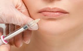 Top Benefits of Filler Injections in Waterloo for Youthful Skin | Dr. Atiyah Plastic Surgery – Site Title