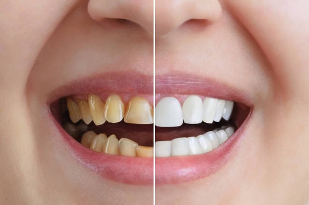Transform Your Smile with Expert Care: Choosing a Cosmetic Dentist in Park Ridge